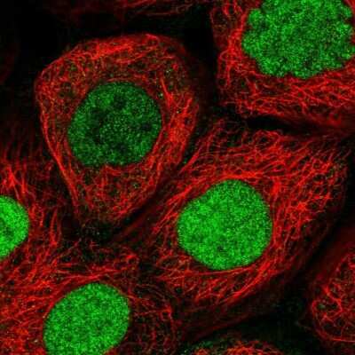 <b>Independent Antibodies Validation. </b>Immunocytochemistry/Immunofluorescence: Exportin-5 Antibody [NBP1-89607] - Immunofluorescent staining of human cell line A-431 shows localization to nucleoplasm.