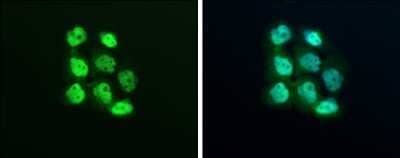 Immunocytochemistry/Immunofluorescence: Exportin-5 Antibody [NBP3-12943] - XPO5 antibody detects XPO5 protein at cytoplasm and nucleus by immunofluorescent analysis. Sample: A431 cells were fixed in 4% paraformaldehyde at RT for 15 min. Green: XPO5 protein stained by XPO5 antibody (NBP3-12943) diluted at 1:500. Blue: Hoechst 33342 staining.