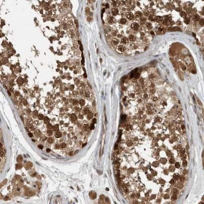 Immunohistochemistry-Paraffin: Exportin-5 Antibody [NBP1-89605] - Staining of human testis shows high expression.