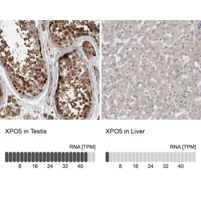 <b>Orthogonal Strategies Validation. </b>Immunohistochemistry-Paraffin: Exportin-5 Antibody [NBP1-89605] - Staining in human testis and liver tissues using anti-XPO5 antibody. Corresponding XPO5 RNA-seq data are presented for the same tissues.