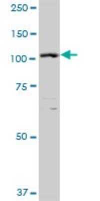 Western Blot: Exportin-5 Antibody [H00057510-B01P] - Analysis of XPO5 expression in C32.