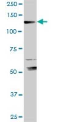 Western Blot: Exportin-5 Antibody [H00057510-D01P] - Analysis of XPO5 expression in IMR-32.