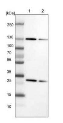 Western Blot: Exportin-5 Antibody [NBP1-89605] - Lane 1: NIH-3T3 cell lysate (Mouse embryonic fibroblast cells). Lane 2: NBT-II cell lysate (Rat Wistar bladder tumor cells).