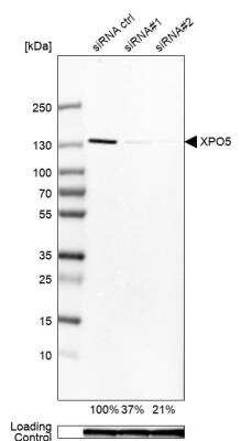 Western Blot: Exportin-5 Antibody [NBP1-89606] - Western blot analysis in Caco-2 cells transfected with control siRNA, target specific siRNA probe #1 and #2. Remaining relative intensity is presented. Loading control: Anti-GAPDH.