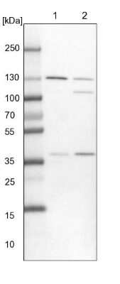 Western Blot: Exportin-5 Antibody [NBP1-89607] - Lane 1: NIH-3T3 cell lysate (Mouse embryonic fibroblast cells). Lane 2: NBT-II cell lysate (Rat Wistar bladder tumor cells).