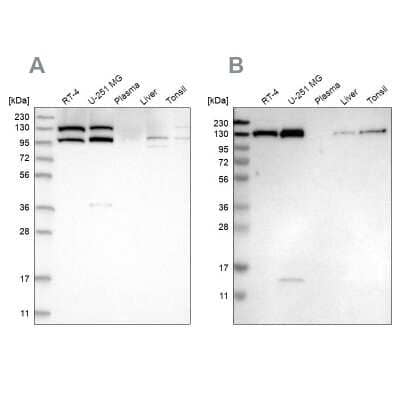 Western Blot: Exportin-5 Antibody [NBP1-89607] - Analysis using Anti-XPO5 antibody NBP1-89607 (A) shows similar pattern to independent antibody NBP1-89606 (B).