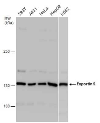 Western Blot: Exportin-5 Antibody [NBP3-12943] - Various whole cell extracts (30 ug) were separated by 5% SDS-PAGE, and the membrane was blotted with Exportin-5 antibody (NBP3-12943) diluted at 1:1000.