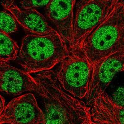 Immunocytochemistry/Immunofluorescence: Exportin-T Antibody [NBP2-55928] - Staining of human cell line MCF7 shows localization to nucleoplasm.