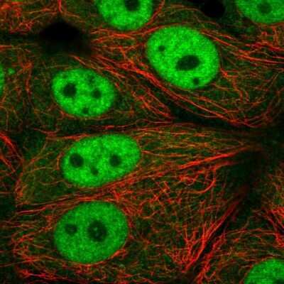 Immunocytochemistry/Immunofluorescence: Exportin-T Antibody [NBP2-56900] - Staining of human cell line MCF7 shows localization to nucleoplasm & cytosol. Antibody staining is shown in green.