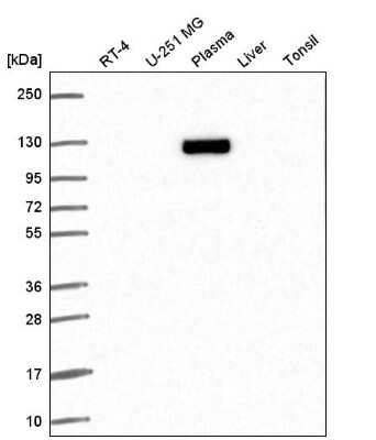 Western Blot: Exportin-T Antibody [NBP2-56900] - Western blot analysis in human cell line RT-4, human cell line U-251 MG, human plasma, human liver tissue and human tonsil tissue.