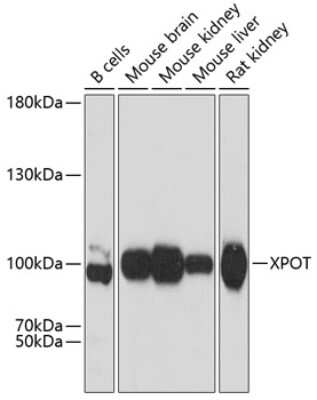 Western Blot: Exportin-T Antibody [NBP3-03339] - Analysis of extracts of various cell lines, using Exportin-T antibody at 1:3000 dilution. Secondary antibody: HRP Goat Anti-Rabbit IgG (H+L) at 1:10000 dilution. Lysates/proteins: 25ug per lane. Blocking buffer: 3% nonfat dry milk in TBST.