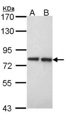 Western Blot: Ext2 Antibody [NBP1-31814] - Sample (30 ug of whole cell lysate) A: A549 B: Hela 7. 5% SDS PAGE; antibody diluted at 1:1000.