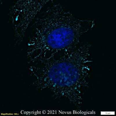Immunocytochemistry/Immunofluorescence: Ezrin Antibody [Alexa Fluor® 647] [NBP2-52977AF647] - HeLa cells were fixed in 4% paraformaldehyde for 10 minutes and permeabilized in 0.05% Triton X-100 in PBS for 5 minutes. The cells were incubated with anti-Ezrin Antibody conjugated to Alexa Fluor 647 (NBP2-52977AF647) at 5 ug/ml for 1 hour at room temperature.  Nuclei were counterstained with DAPI (Blue).  Cells were imaged using a 40X objective.