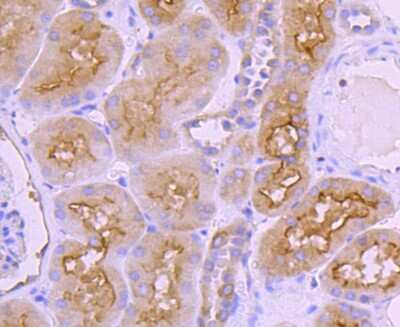 Immunohistochemistry-Paraffin: Ezrin Antibody (JM10-65) [NBP2-66827] - Analysis of paraffin-embedded human kidney tissue using anti-Ezrin antibody. Counter stained with hematoxylin.