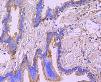 Immunohistochemistry-Paraffin: Ezrin Antibody (JM10-65) [NBP2-66827] - Analysis of paraffin-embedded human lung tissue using anti-Ezrin antibody. Counter stained with hematoxylin.