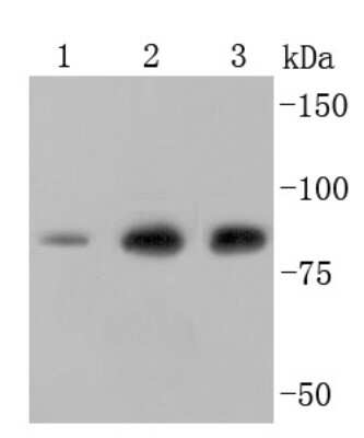 Western Blot: Ezrin Antibody (JM10-65) [NBP2-66827] - Analysis of Ezrin on different cell lysates using anti-Ezrin antibody at 1/1,000 dilution. Positive control: Lane 1:Hela Lane 2: Jurkat Lane 3:A431