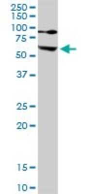 Western Blot: Ezrin Antibody [H00007430-D01P] - Analysis of EZR expression in human kidney.