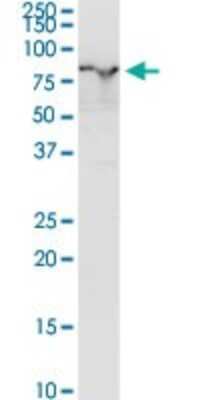 Western Blot: Ezrin Antibody [H00007430-D01P] - Analysis of EZR expression in human liver.