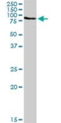 Western Blot: Ezrin Antibody [H00007430-D01P] - Analysis of EZR expression in mouse spleen.