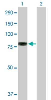 Western Blot: Ezrin Antibody [H00007430-D01P] - Analysis of EZR expression in transfected 293T cell line by EZR polyclonal antibody.Lane 1: EZR transfected lysate(69.40 KDa).Lane 2: Non-transfected lysate.