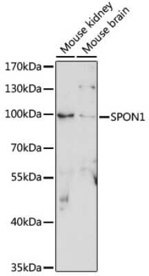 Western Blot: F-Spondin/SPON1 Antibody [NBP3-03648] - Analysis of extracts of various cell lines, using F-Spondin/SPON1 antibody at 1:1000 dilution. Secondary antibody: HRP Goat Anti-Rabbit IgG (H+L) at 1:10000 dilution. Lysates/proteins: 25ug per lane. Blocking buffer: 3% nonfat dry milk in TBST.