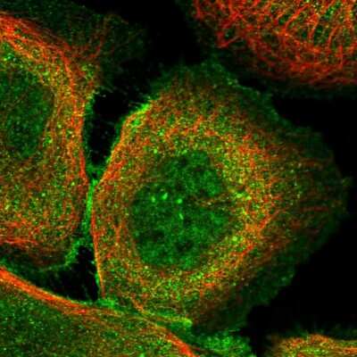 Immunocytochemistry/Immunofluorescence: F box protein 38 Antibody [NBP1-87932] - Staining of human cell line A-431 shows localization to nucleoplasm & plasma membrane. Antibody staining is shown in green.