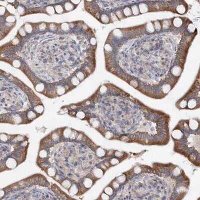 Immunohistochemistry-Paraffin: F box protein 38 Antibody [NBP1-87932] - Staining of human small intestine shows moderate cytoplasmic positivity in glandular cells.