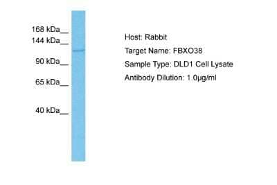 Western Blot: F box protein 38 Antibody [NBP2-87387] - Host: Rabbit. Target Name: FBXO38. Sample Tissue: Human DLD1 Whole Cell lysates. Antibody Dilution: 1ug/ml