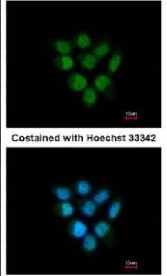 Immunocytochemistry/Immunofluorescence: F-box protein 43 Antibody [NBP1-31473] - Paraformaldehyde-fixed A431, using antibody at 1:200 dilution.