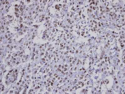 Immunohistochemistry-Paraffin: F-box protein 43 Antibody [NBP1-31473] - Paraffin-embedded Saos-2 xenograft, using antibody at 1:100 dilution.