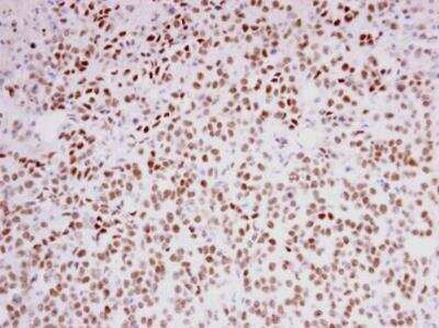 Immunohistochemistry-Paraffin: F-box protein 43 Antibody [NBP1-31473] - Paraffin-embedded TOV-21G xenograft. FBXO43 antibody [C3], C-term diluted at 1:250.