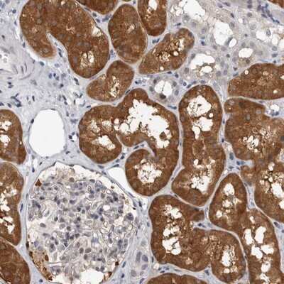 Immunohistochemistry-Paraffin: F-box protein 43 Antibody [NBP1-84709] - Staining of human kidney shows distinct cytoplasmic positivity in cells in tubules.