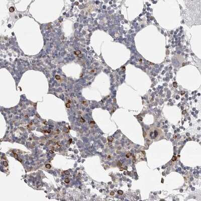 Immunohistochemistry-Paraffin: F-box protein 43 Antibody [NBP1-84710] - Staining of human bone marrow shows strong cytoplasmic positivity in subsets of bone marrow poietic cells.