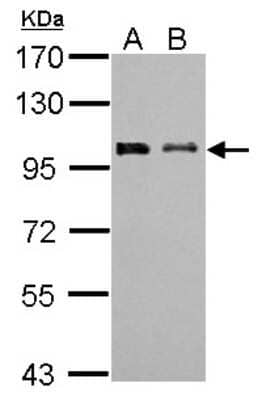 Western Blot: F-box protein 43 Antibody [NBP1-31473] - Sample (30 ug of whole cell lysate) A: NIH-3T3 B: JC 7. 5% SDS PAGE; antibody diluted at 1:1000.