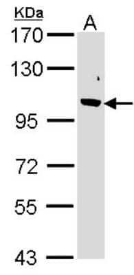Western Blot: F-box protein 43 Antibody [NBP1-31473] - Sample (30 ug of whole cell lysate) A: 293T 7. 5% SDS PAGE; antibody diluted at 1:1000.