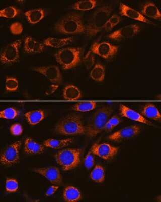 Immunocytochemistry/Immunofluorescence: FAAH Antibody (10A1M7) [NBP3-16330] - Immunofluorescence analysis of NIH-3T3 cells using FAAH Rabbit mAb (NBP3-16330) at dilution of 1:100 (40x lens). Blue: DAPI for nuclear staining.