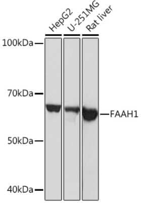 Western Blot: FAAH Antibody (10A1M7) [NBP3-16330] - Western blot analysis of extracts of various cell lines, using FAAH Rabbit mAb (NBP3-16330) at 1:1000 dilution. Secondary antibody: HRP Goat Anti-Rabbit IgG (H+L) at 1:10000 dilution. Lysates/proteins: 25ug per lane. Blocking buffer: 3% nonfat dry milk in TBST. Detection: ECL Basic Kit. Exposure time: 30s.