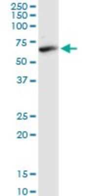 Western Blot: FAAH Antibody (2G8) [H00002166-M01] - FAAH monoclonal antibody (M01), clone 2G8. Analysis of FAAH expression in rat muscle.