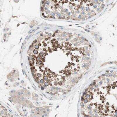 Immunohistochemistry-Paraffin: FAAH Antibody [NBP1-83937] - Staining of human testis shows moderate membranous positivity in cells in seminiferous ducts.