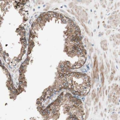 Immunohistochemistry-Paraffin: FAAH Antibody [NBP1-83937] - Staining of human prostate shows moderate cytoplasmic positivity in glandular cells.