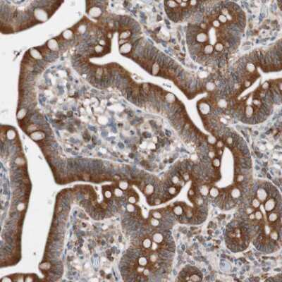 Immunohistochemistry-Paraffin: FAAH Antibody [NBP1-83937] - Staining of human Small intestine shows strong cytoplasmic positivity in glandular cells.