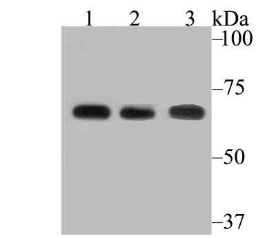 Western Blot: FAAH Antibody (JG43-07) [NBP2-76834] - Western blot analysis of FAAH1 on different lysates using anti-FAAH1 antibody at 1/2,000 dilution.Positive control:Lane 1: SK-Br-3 Lane 2: Mouse cerebellumLane 3: Mouse lung