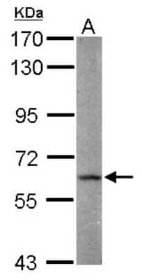 Western Blot: FAAH Antibody [NBP2-16397] - Sample (30 ug of whole cell lysate) A: MCF-7 7. 5% SDS PAGE gel, diluted at 1:1000.