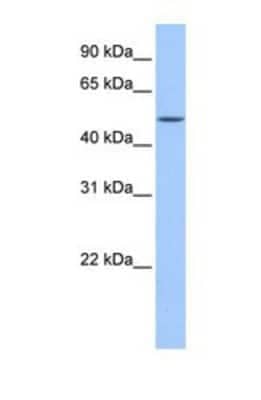 FAAH2 Antibody (NBP1-69705): Novus Biologicals