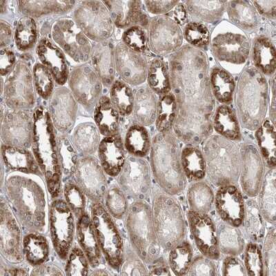 Immunohistochemistry-Paraffin FAAP100 Antibody