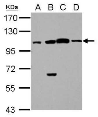 Western Blot: FAAP100 Antibody [NBP2-15635] - Sample (30 ug of whole cell lysate) A: Jurkat B: K562 C: HL-60 D: NCI-H929 7. 5% SDS PAGE gel, diluted at 1:1000.