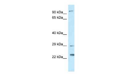 Western Blot: FAAP100 Antibody [NBP2-87388] - WB Suggested Anti-C17orf70 Antibody. Titration: 1.0 ug/ml. Positive Control: Placenta