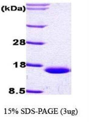 SDS-Page: Recombinant Human FABP1/L-FABP Protein [NBC1-18503] -  FABP1, 16kDa (147aa), confirmed by MALDI-TOF with a purity of 95% by SDS - PAGE