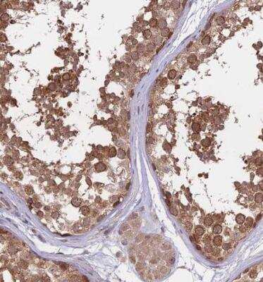 Immunohistochemistry-Paraffin: FABP12 Antibody [NBP1-93537] - Staining of human testis shows strong cytoplasmic positivity in cells of seminiferus ducts.