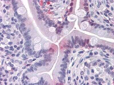 Immunohistochemistry-Paraffin: FABP2/I-FABP Antibody (9A9B7B3) [NBP1-51589] - Analysis of paraffin-embedded human Small Intestine tissues.